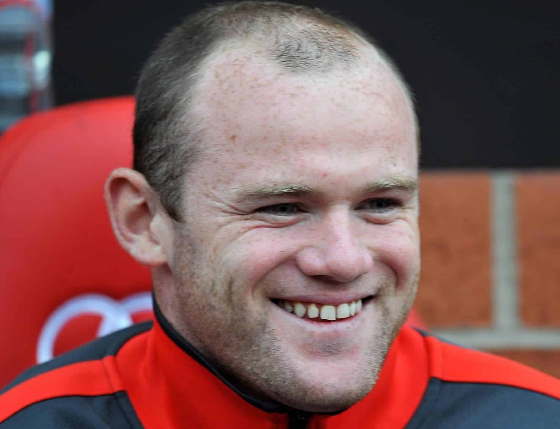 Wayne Rooney's mature hairline