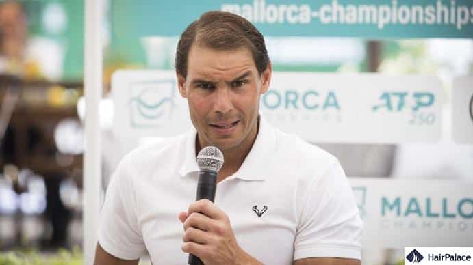 The hair loss of Rafael Nadal