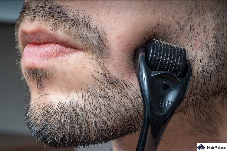 derma roller for beard grwoth