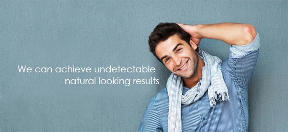 hair transplant cost hair transplant cost