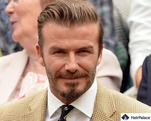Gossips About David Beckham’s Hair Transplant - HairPalace Hairclinic
