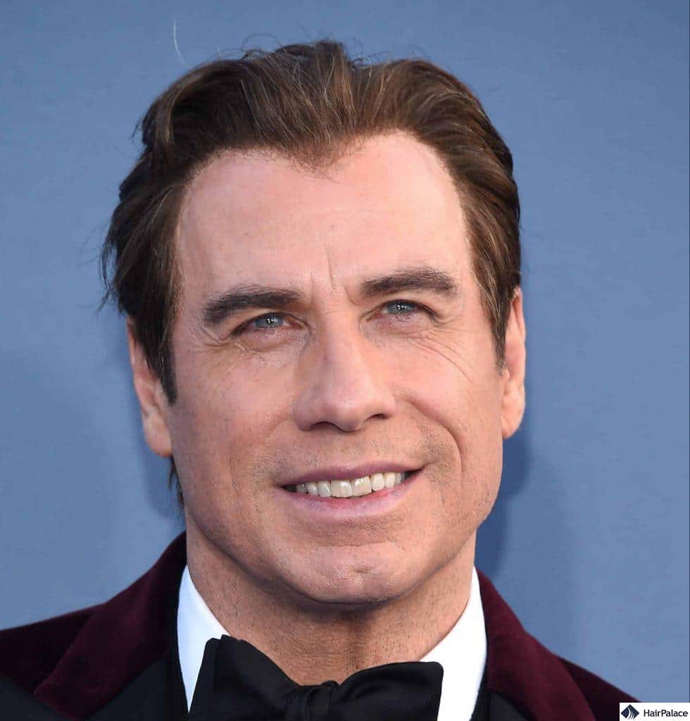 Travolta wearing a toupee with sing of it showing at the hairline