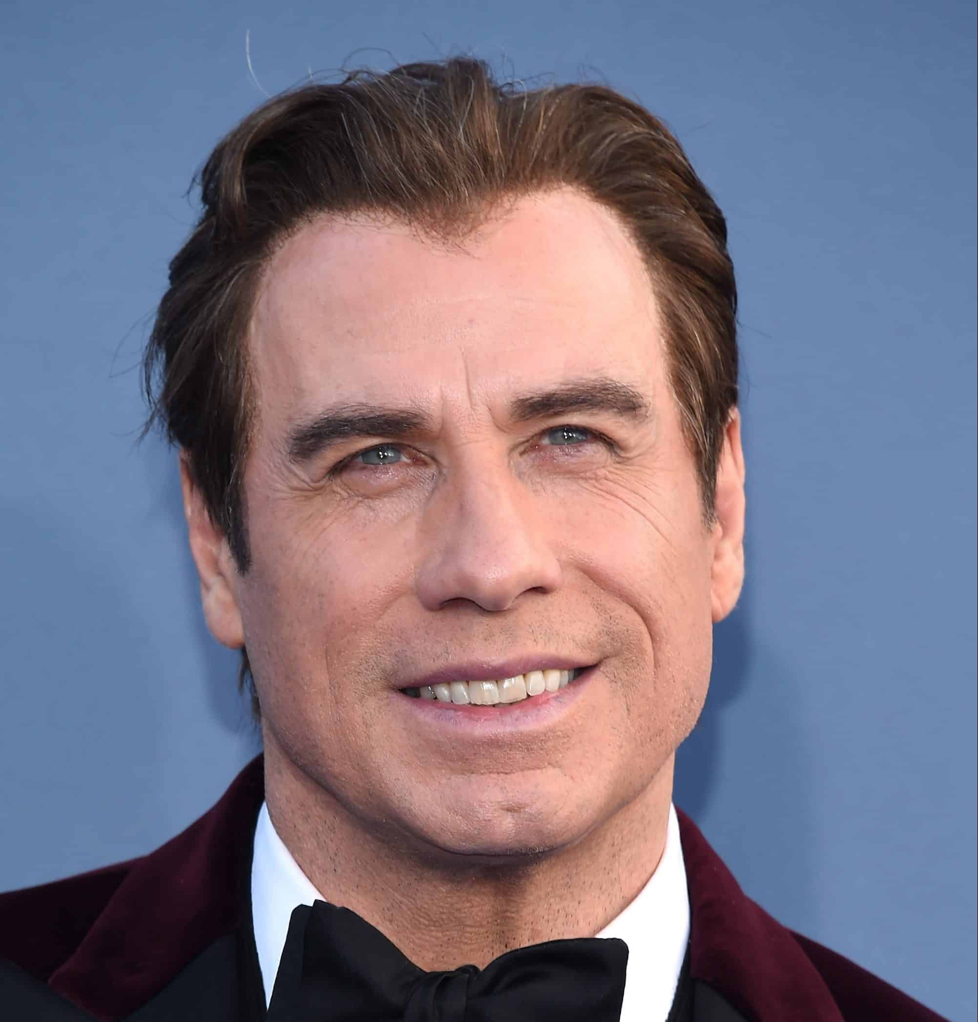 john travolta hairline