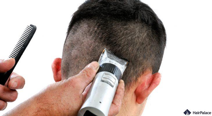 Haircut before the hair transplant? The Ultimate Guide | HairPalace