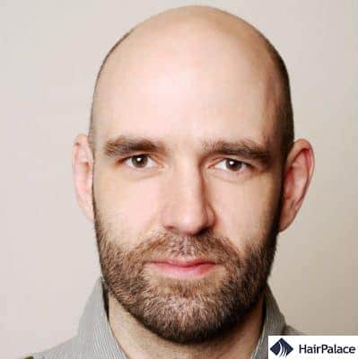 Why Shouldn T You Be Afraid Of The Haircut Before The Hair Transplant