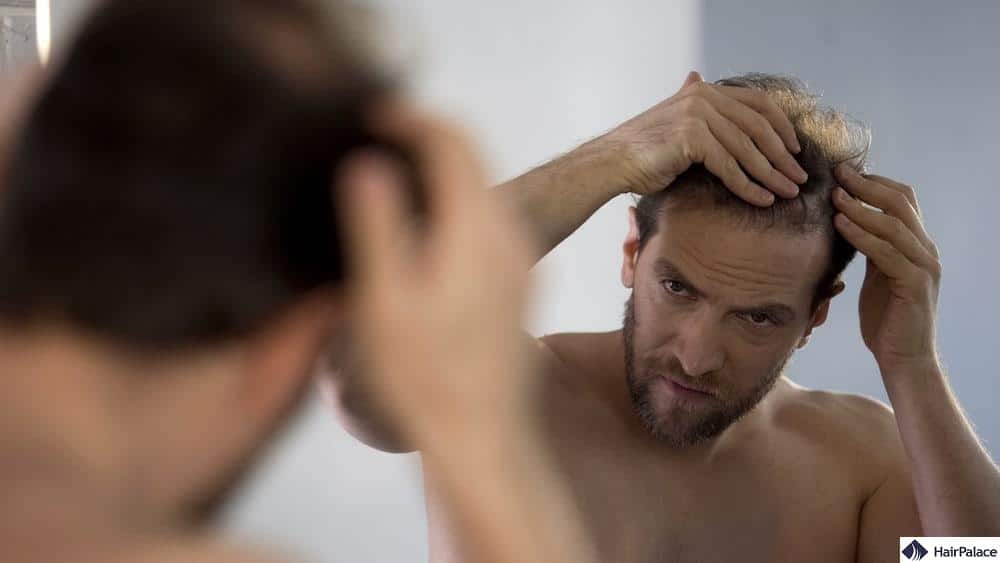 Can I Have a Second Hair Transplant? Can I Have a Second Hair Transplant?