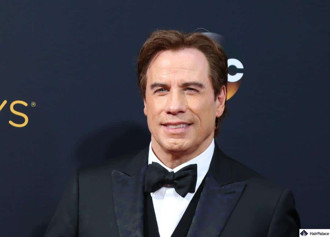john travolta hairline