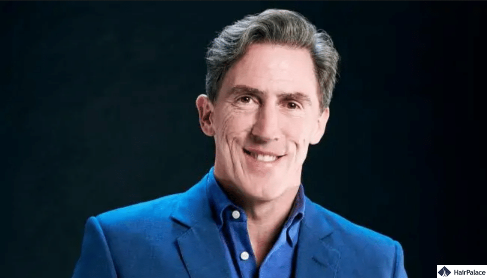 Rob Brydon Hair Transplant | Are the Rumours Confirmed?