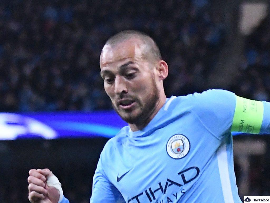 David Silva bald in 2017 hairloss