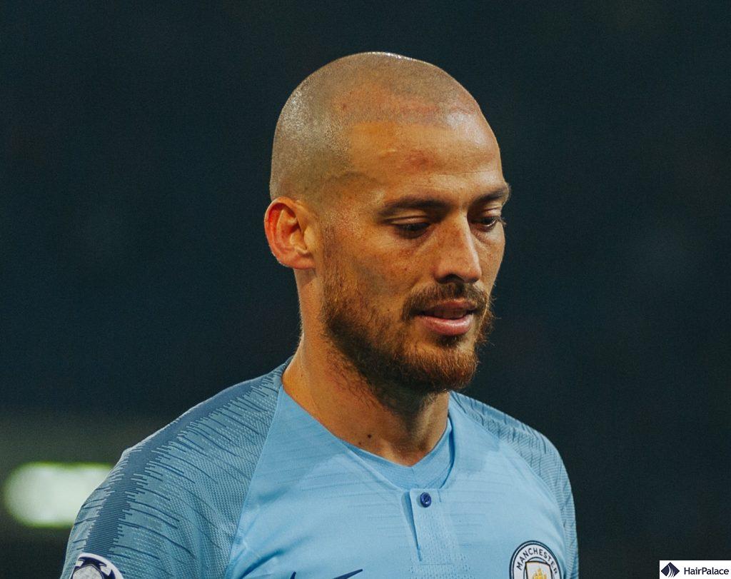 David Silva extended hairline