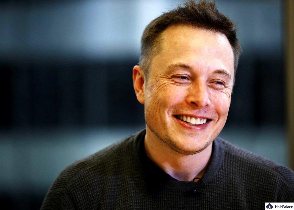 Elon Musk hair transplant result