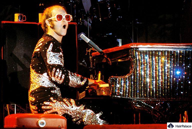 Elton John Hair Transplant What Treatment Did He Choose?