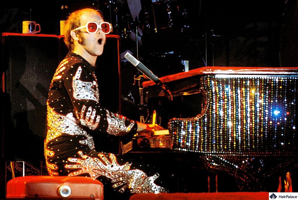 Elton John's hair loss in 1975