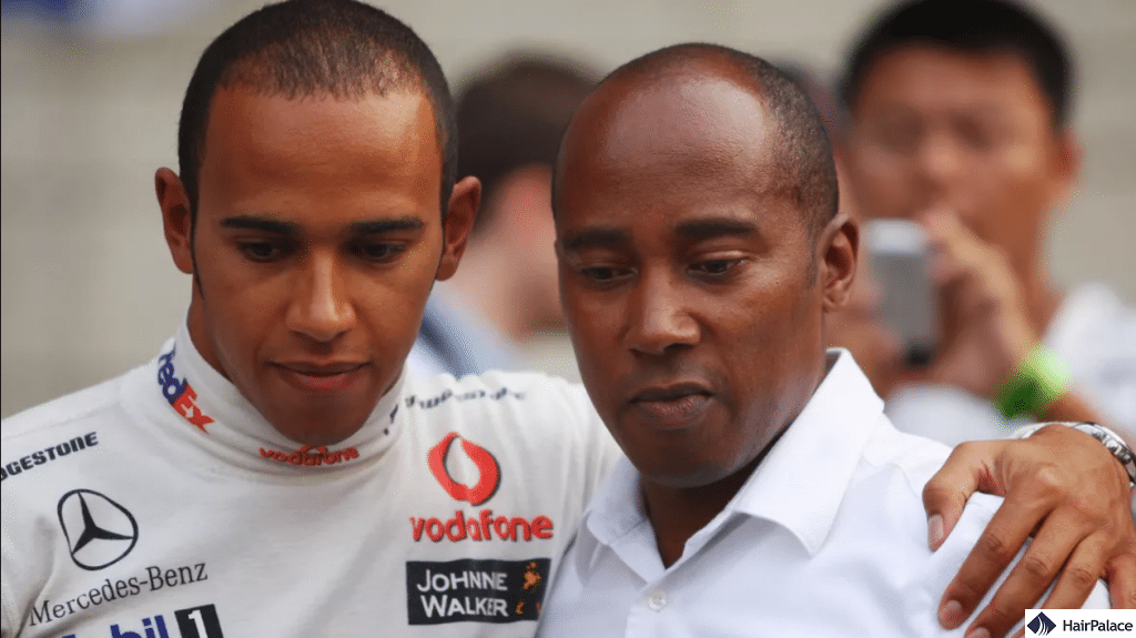 Hamilton’s hair loss could result from a family history of baldness