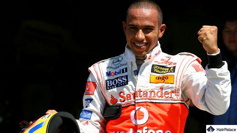 Lewis Hamilton’s receding hairline