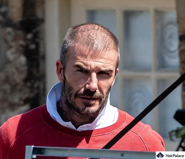 David Beckham hair transplant rumours 2020