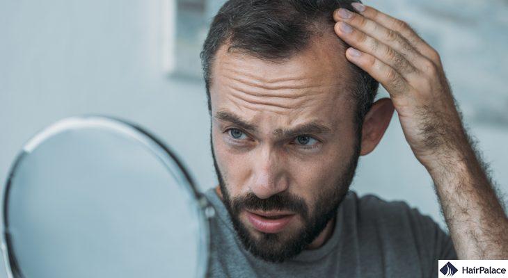 how to stop balding