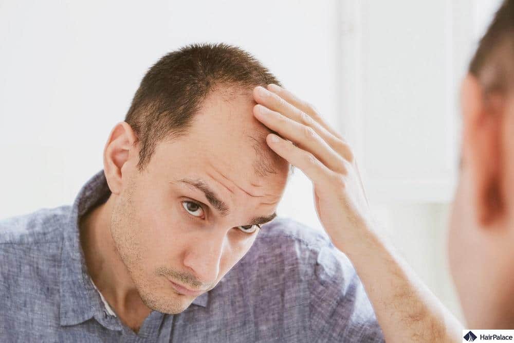 men hair loss