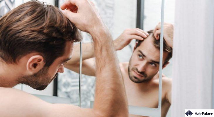 balding signs hair loss