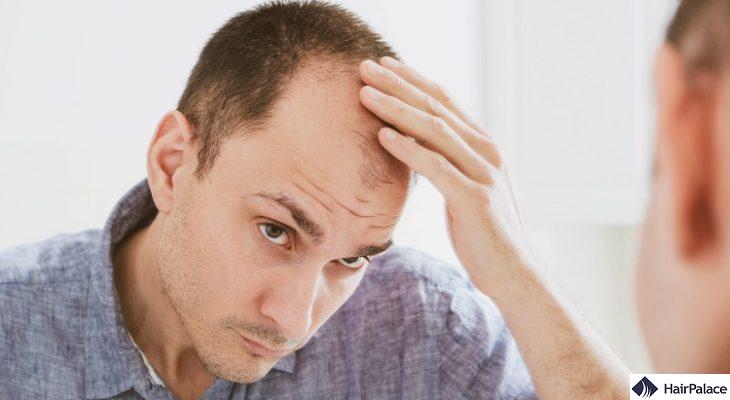 how much hair loss is normal?