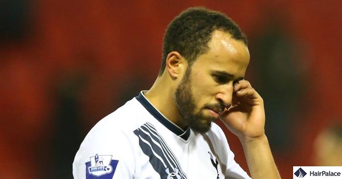 Andros Townsend receding hairline