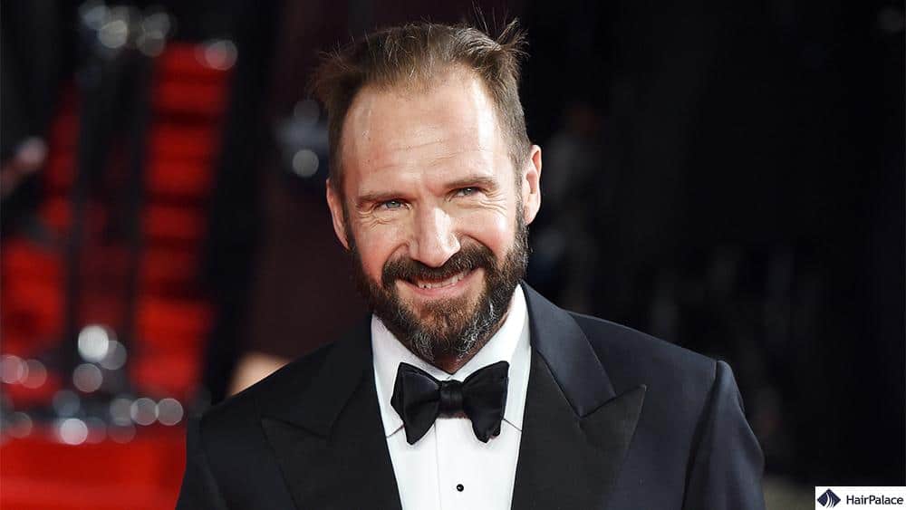 ralph fiennes thinning hair