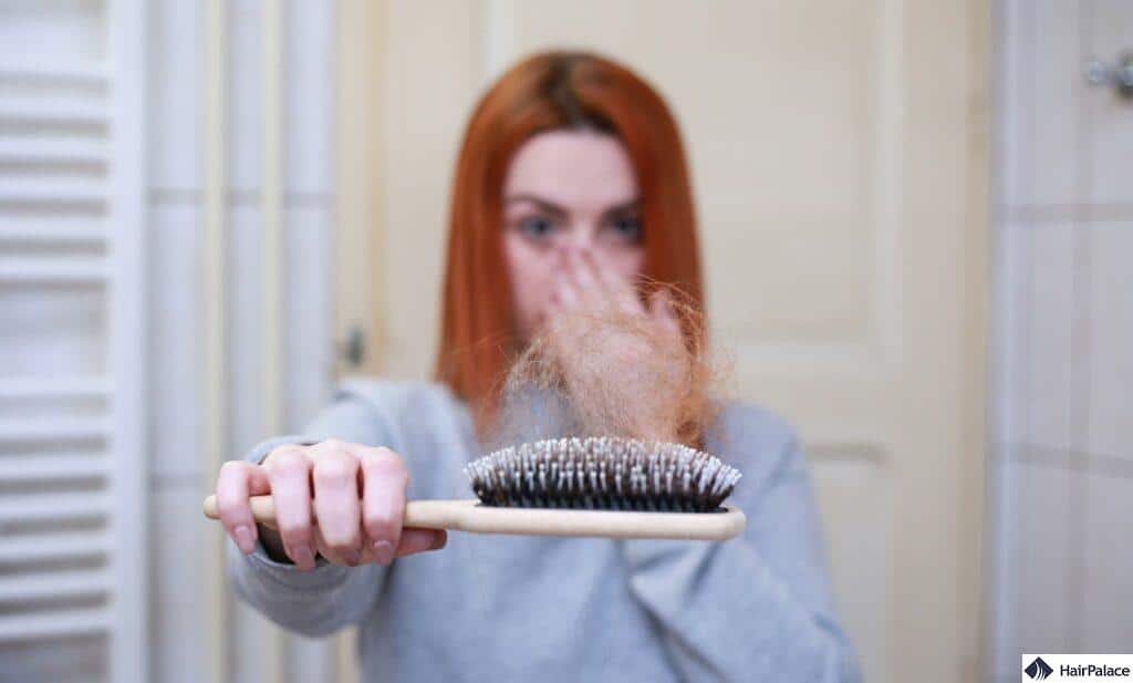 Female pattern baldness