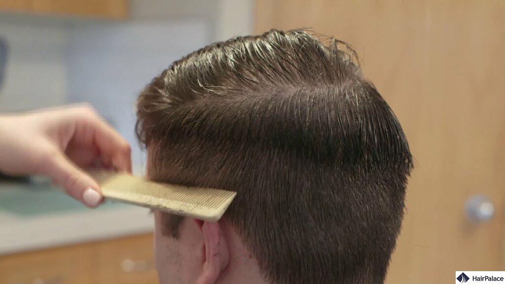 hair growth in men