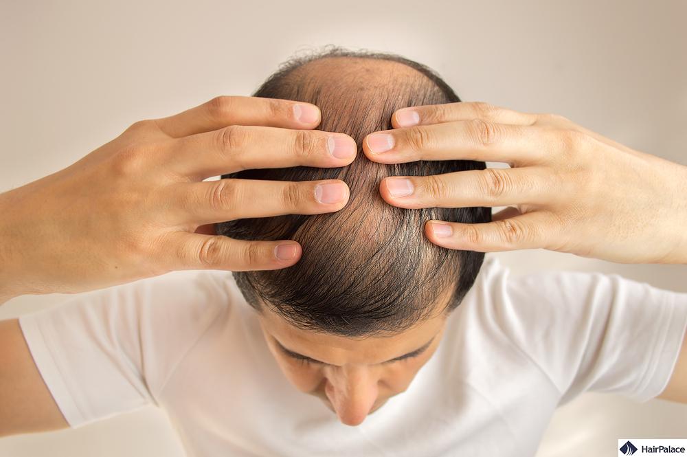 solutions for hair loss