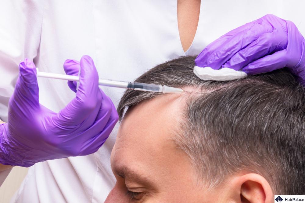 prp to treat hair loss