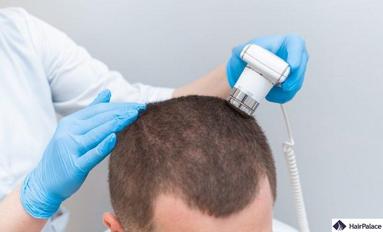 hair and scalp examination is needed to diagnose alopecia areata