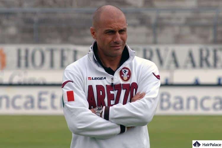 Antonio Conte went completley bald when he first started coaching Arezzo