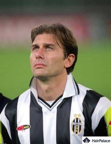 Antonio Conte's hair went through a miracolous comeback by the time he went to Juventus