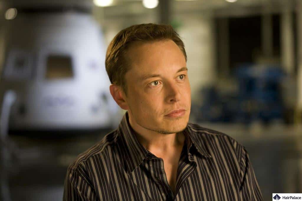 Elon-Musk-hairline