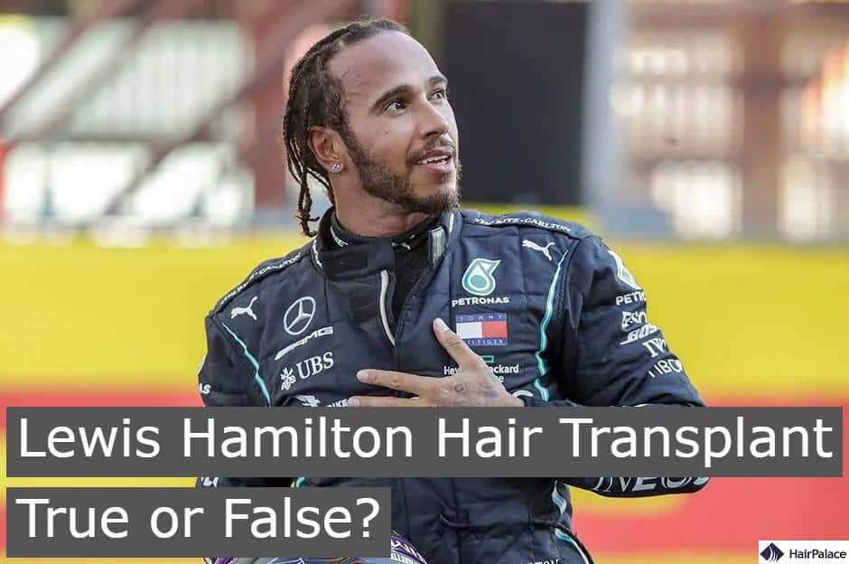 Lewis Hamilton hair transplant true or false