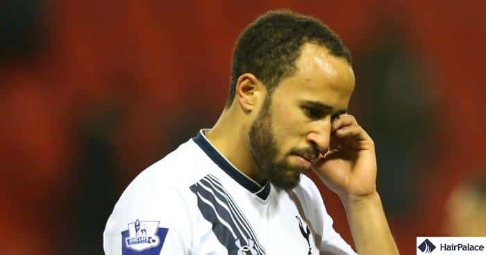 hair loss of andros townsend