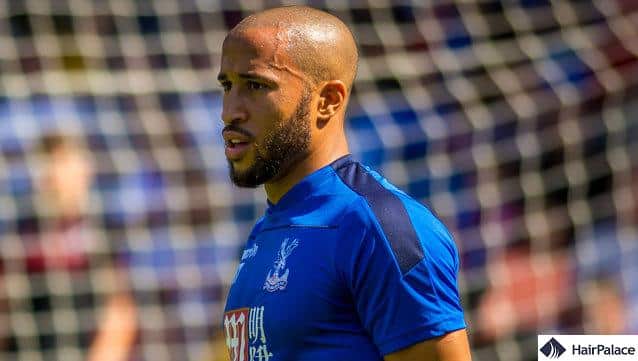 hairline of andros townsend