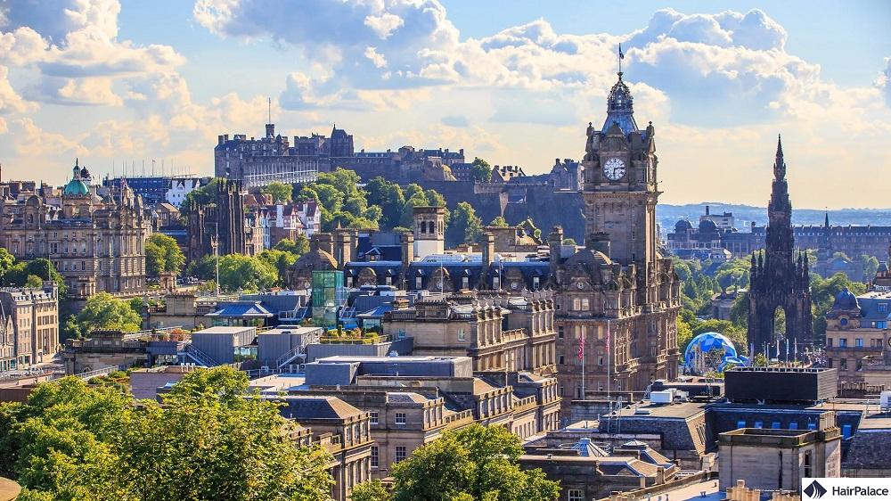 edinburgh hair transplant