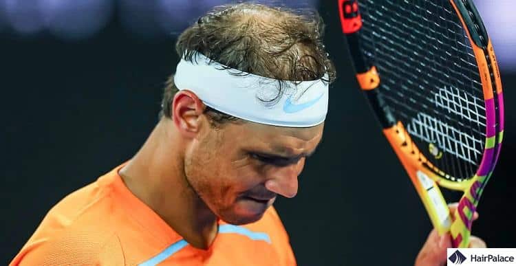 Rafael Nadal hair loss in 2023