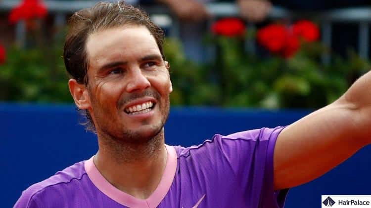 Rafael Nadal hair loss became noticable by the time he was in his late 20s
