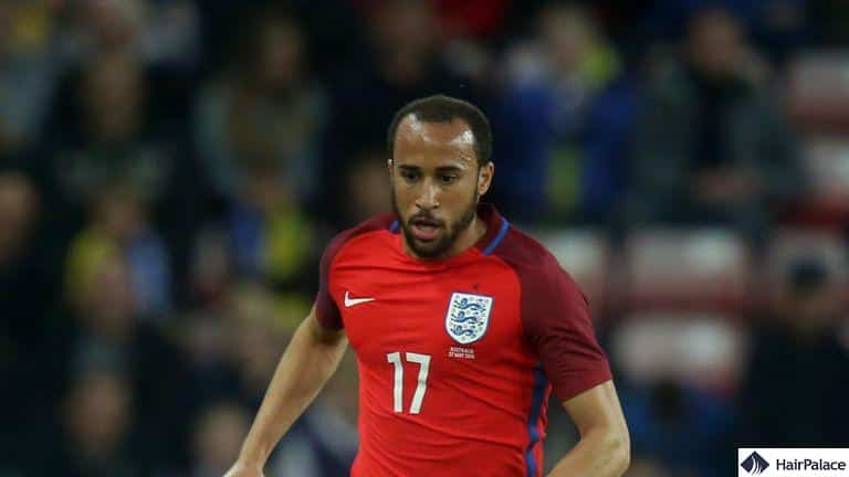 baldness of andros townsend