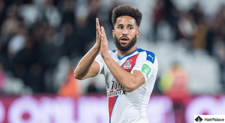 hair transplant story of andros townsend
