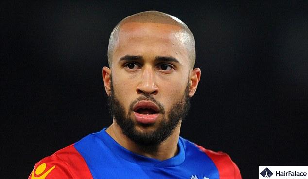 Andros Townsend went completely bald for a time