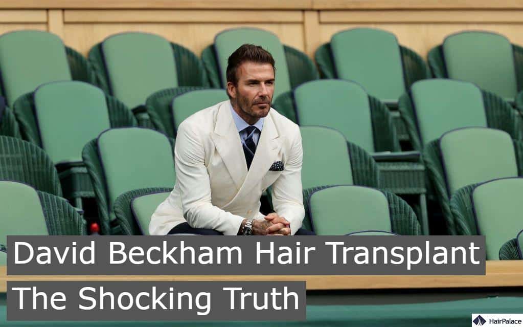 David Beckham Hair Transplant Story
