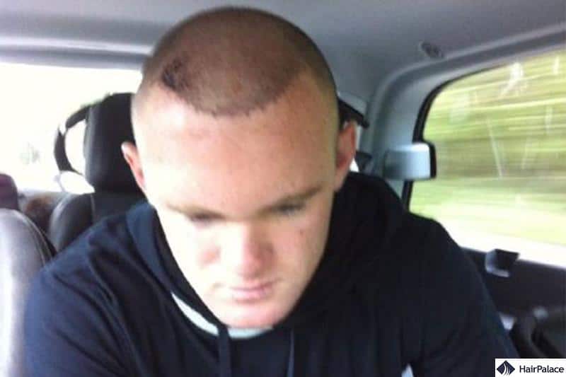 Wayne Rooney showing off his new hairs