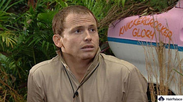 joe swash balding