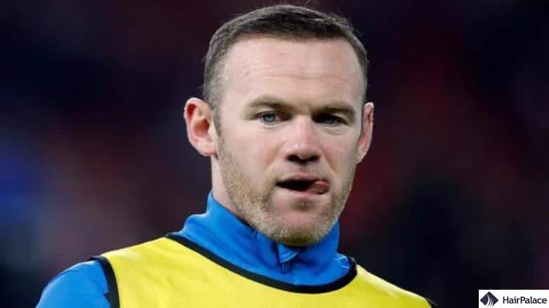 Wayne Rooney second hair transplant in 2013