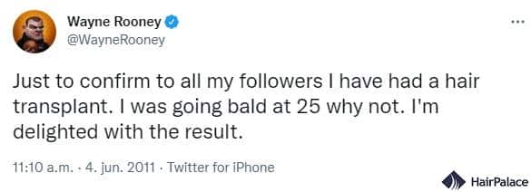 Wayne Rooney tweet about his hair transplantation