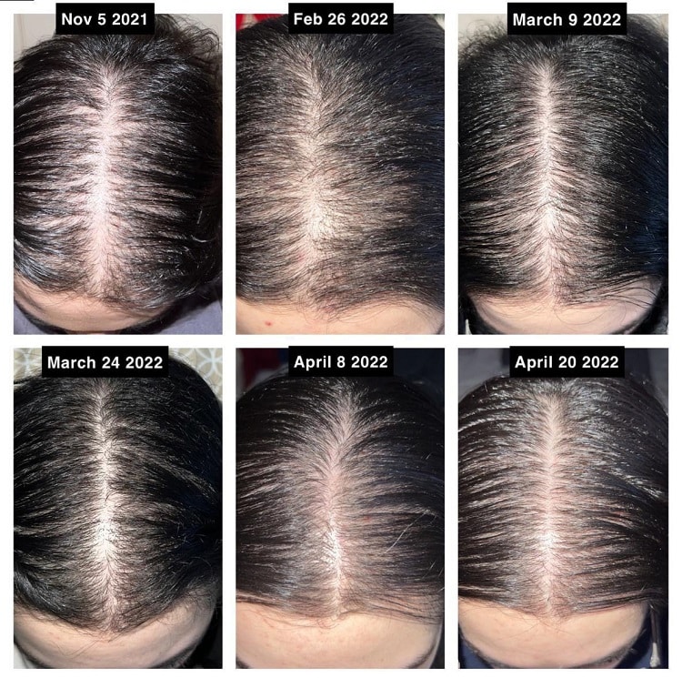 1 month rosemary oil for hair growth results