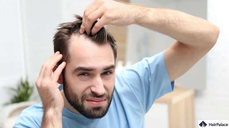 covid may accelerate hair loss